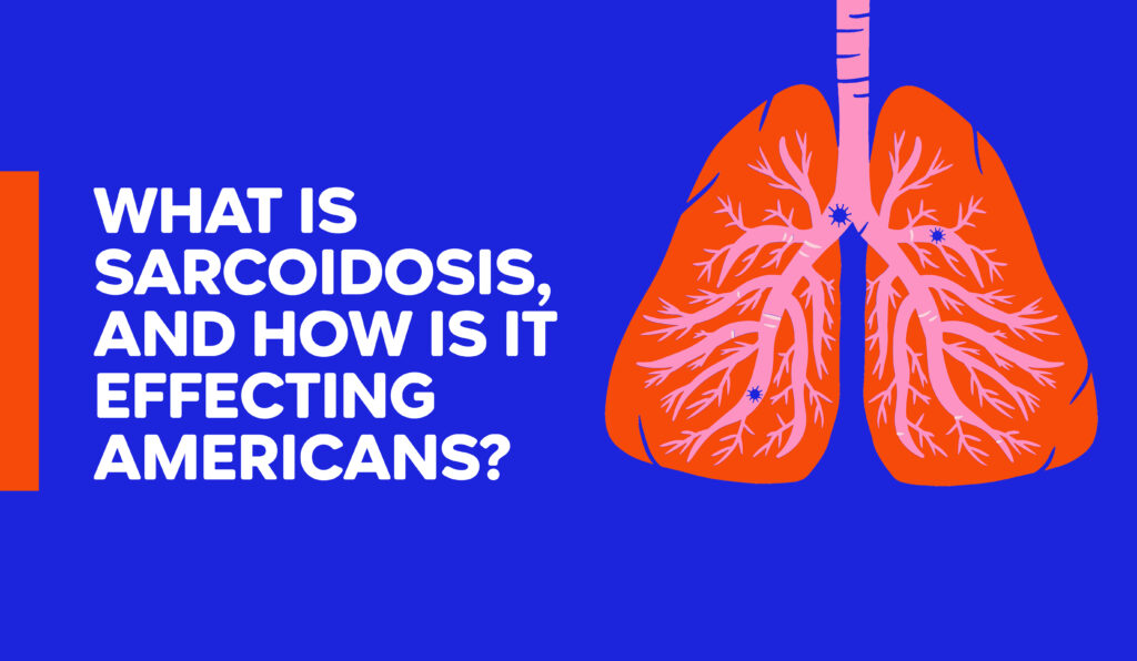 What is Sarcoidosis and how does it effect Americans?